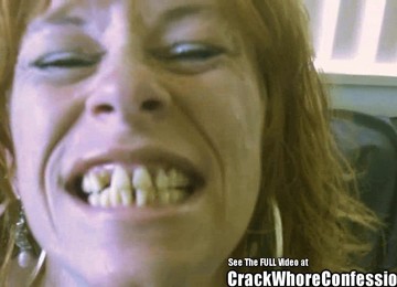 Donkey Teeth Red Head Mom Crack Slut