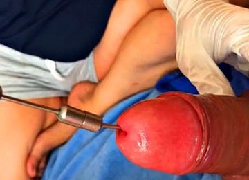 My Wife Inserts A Long Chain Of Urethra Into My Bladder