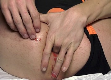 Ado Anal, Fat Anal, Muy De Cerca